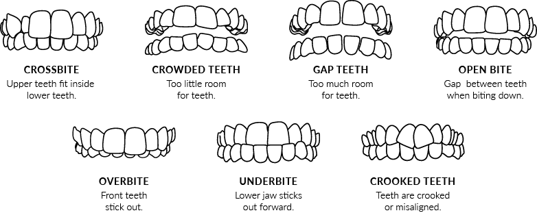 Invisalign Smile Assessment, Comox Valley Dental Centre