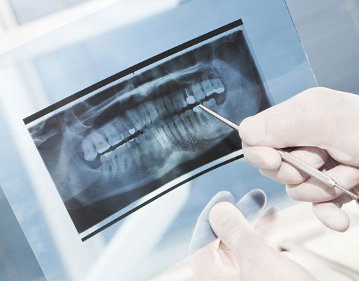 Dental X rays, Dentist Comox